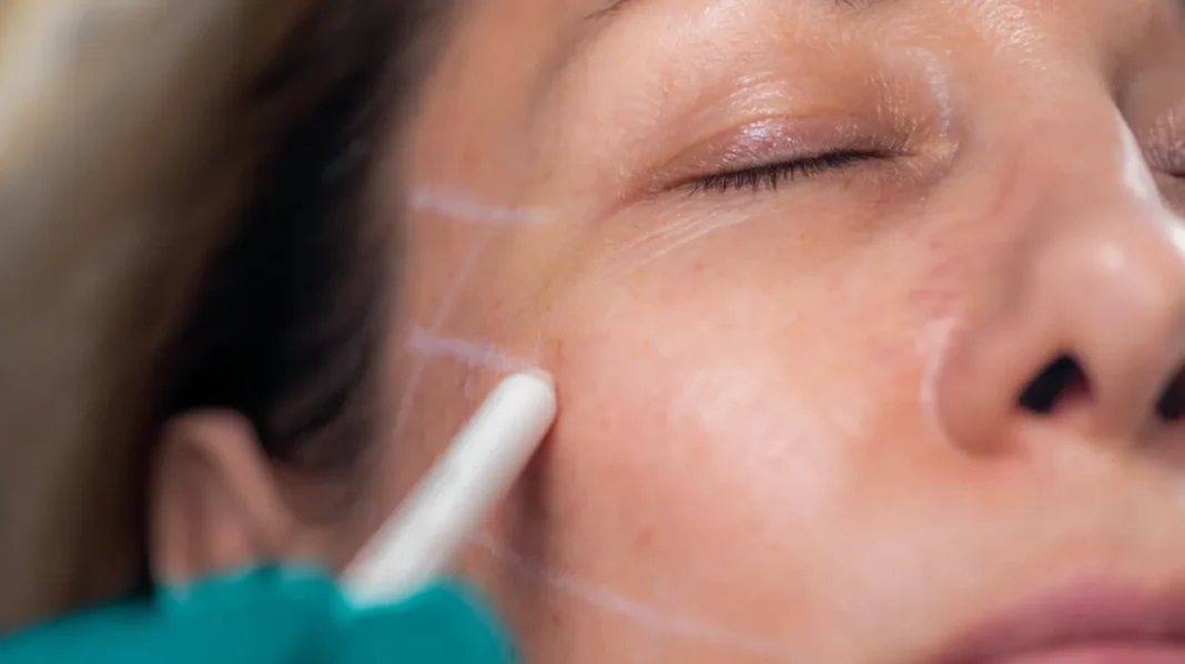 A Comprehensive Guide To Plastic Surgery: Everything You Need To Know